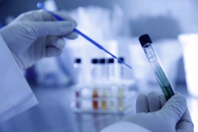 Capacitación en Toxicología Forense